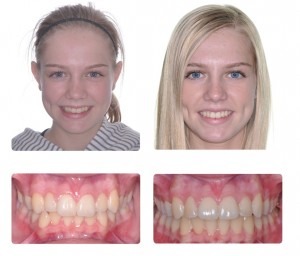 Before and after treatment