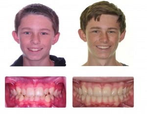Before and after treatment