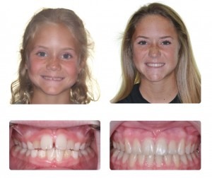 Before and after treatment