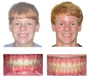 Before and after treatment