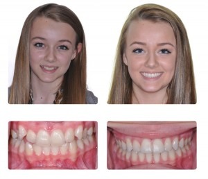 Before and after treatment